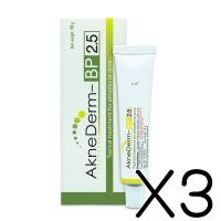 ราคา (ซื้อ3 ราคาพิเศษ) VITARA AkneDerm BP 2.5% 10G ละลายหัวสิว ลดสิวอุดตันและสิวเสี้ยน ลดและป้องกันการเกิดสิว (3324)