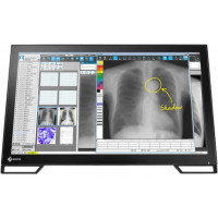 ราคา Monitor EIZO RadiForce MS236WT-A (667ceac1aea7dea337330cd4)