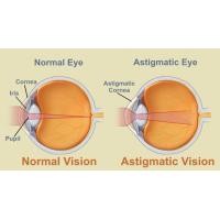 ราคา เรื่องงมงาย..เกี่ยวกับสายตาเอียง (97)