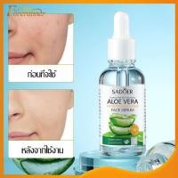 ราคา เอสเซ้นส์ สารสกัดว่านหางจระเข้ ผิวเรียบเนียน ให้ความชุ่มชื้น ลดจุดด่างดํา Sadoer Aloe Vera Essence30ML 880 (23540626288)