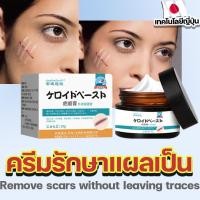 ราคา ยาลดแผลเป็น แผลเป็น scar removal cream ครีมแผลเป็น ลดเลือนป้องกันรอยแผลเป็นลบแผลเป็น ทาแผลเป็น ครีมทาแผล ลดรอยแผล (25275127303)