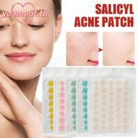 ราคา คุณมูต 40ชิ้น แผ่นแผ่นแปะสิว การดูแลผิวที่มีสีสันสิวปกสติกเกอร์ รักษาสิวที่มองไม่เห็นน่ารักรูปดาวแผ่นแปะสิว (28628203623)
