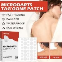 ราคา แพทช์สิว แถบสิว สติ๊กเกอร์ดูแลผิวหน้า น้ํายาลบฝ้า ระบายอากาศได้ สําหรับการใช้งานทุกวัน ค้างคืน ทํางานที่บ้าน pouisth (24147534765)