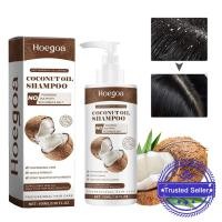 ราคา แชมพูน้ํามันมะพร้าวป้องกันรังแคซ่อมแซมความเสียหายแห้งผมควบคุมบํารุงผมหนังศีรษะทําความสะอาด Z8z4 (28265548572)