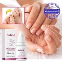 ราคา เซรั่มเล็บ เซรั่มซ่อมแซมเล็บ Essence เซรั่ม Fungal Nail Onychomycosis Foot Care Nail Toe Nourishing Y1z3 (27631731167)