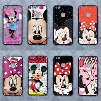 ราคา เคส Huawei P10 lite ลายมิกกี้ มินนี่ ขอบนิ่มหลังแข็ง เคสมือถือ เคสโทรศัพท์ Case (9313707679)