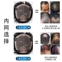 ราคา วิกผมชาย ผมสั้น ผมจริง ไม่มีรอยต่อ มองไม่เห็น หล่อ เต็ม ผมจริง ผู้ชาย ชิ้นแพทช์ หัวเปลี่ยน ชาย 20250606 (44253442874)