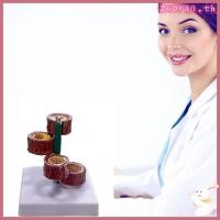 ราคา ZUO Blood Vessel Anatomical Atherosclerosis Model Blood Vessel แบบจําลองกายวิภาคศาสตร์ (51255837533)