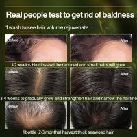 ราคา สบู่แชมพูใบไซเปรส บำรุงรากผม (41619453958)