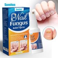 ราคา การรักษาเล็บ Essential Anti Fungal Infection Toe Hand Foot Skin Care 30ml สเปรย์บรรเทา (26976089956)