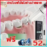ราคา ที่ขูดหินปูน แปรงสีฟันไฟฟ้า เครื่องขูดหินปูนไฟฟ้า ขจัดหินปูนฟัน โหมดทำความสะอาดทันตกรรม 6 ขั้นตอน 31000 นาที (43119188873)