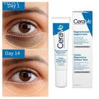 ราคา Feelfly Eye Cream Repair Skin Barrier สําหรับ Dark Circles ใต้ตา Moisturizing ลด Black Circle Eye Cream Whitening Anti Fine เส้น Eye Care Q4Z4 (26900392281)