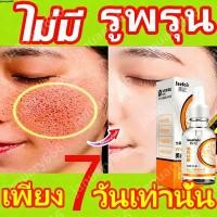 ราคา ครีมทาฝ้า 30ml ครีมถาหน้าขาว ครีมทาฝ้าหนาๆ ช่วยกำจัดฝ้ากระ จุดดำ ฝ้าถูกแดดเผาอย่างเป็นมืออาชีพ ทำให้ผิวขาว ลดสิว ฝ้า กระ (40378075873)
