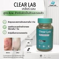 ราคา clear lab skin acne moist ampoule gel (28484799410)