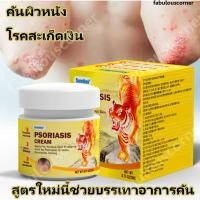 ราคา ครีมทาสังคัง สะเก็ดเงินครีม ครีมบำรุงผิว รอยแดง โรคผิวหนัง เกลื้อน กลาก คัน สมุนไพร แก้คันเรื้อรัง คันในร่มผ้า คันในร่มผ (57807613605)