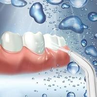 ราคา R Flosser เปลี่ยนเคล็ดลับสําหรับ Waterpik Oral Irrigator เคล็ดลับจัดฟันเปลี่ยน (56003919318)