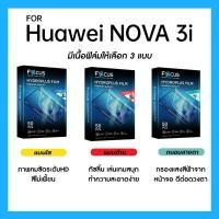 ราคา ฟิล์มไฮโดรพลัส Focus สำหรับ Huawei Nova 3i เต็มจอ มีอุปกรณ์ติดฟิล์มให้ (26062659819)