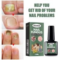ราคา EELHOE Hand and Foot Onychomycosis Repair Solution Nail care and repair for onychomycosis thickening and softening nail solution (52109660534)