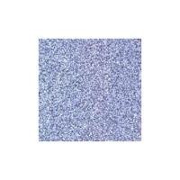 ราคา กระเบื้อง พื้น DURAGRES 12x12 DKW-450 SLATE A (2473)
