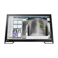 ราคา Monitor EIZO RadiForce MS236WT-A (667ceac1aea7dea337330cd4)