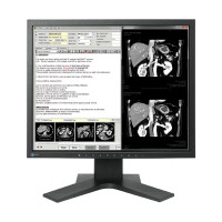 ราคา Monitor EIZO RadiForce MX194 (667ce7c0aea7dea337330bbc)