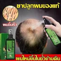 ราคา （7day หนาแน่น）สเปรย์เร่งผมยาวx9 เซรั่มบํารุงผม เซรั่มบำรุงผม นีโอแฮร์โลชั่น นีโอแฮร์ หัวล้าน ปลูกหนวด เซรั่มเร่งผมยาว ผมร่วง ผมบาง (1730982248534281215)