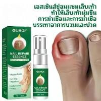 ราคา Toenail Repair Weak Nails Fungal Nails Yellow Thickened Armor Oil Relief Ingrown Nails West and Month Apply to relieve ingrown nails, mucus, care for soft nails, nail grooves (1732118578567808355)