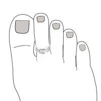 ราคา MT แหวนนิ้วเท้าเงินแท้ ลายเส้น ประดับรูปช้าง Sterling Silver Toe Ring (str072) MT Jewelry มณีธารา คําแนะนําผลิตภัณฑ์ใหม่ของเดือนนี้ สร้อย คอเงิน แท้ (1731761837636028104)