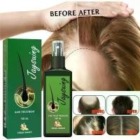 ราคา [บอกลาหัวล้าน ปลูกผมหนา ช่วยลดผมร่วง ]สเปรย์ปลูกผม ยาปลูกผม ป้องกันผมร่วงน้ำยาเร่งผมยาว น้ำยาปลูกผม เร่งผมยาวไว แก้ปัญหาผมร่วง ปลูกผม เซรั่มบำรุงผม ยาปลูกผมผู้ชาย สเปรย์ปปลูกผม ป (1732108020173211480)