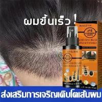 ราคา สเปรย์เร่งผมยาวx9 น้ํายาปลุกผม เซรั่มปลูกผม น้ำยาปลูกผม ฟื้นฟูผม ควบคุมผมร่วงล่วงหน้า เซรั่มบำรุงผม เร่งผมขึ้นใหม่ รักษาผม ลดผมร่วง (1732693507153889009)