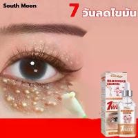 ราคา เห็นผลชัดเจน South Moon ครีมบำรุงรอบตา 30ml รอบดวงตา ลดถุงใต้ตา ครีมบำรุงใต้ตา ยกกระชับ เม็ดไขมัน ครีมทาตาเม็ดไขมัน ครีมทาใต้ตาดำ ครีมกำจัดถุงใต้ตา อายครีม อายครีมริ้วรอย ครีมบำร (1732177052061895149)