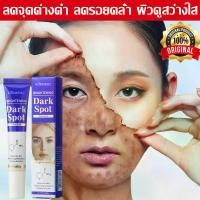 ราคา อ่อนโยนและหวาน ครีมลดฝ้า 7 วัน, ครีมฝ้า, ครีมไวท์เทนนิ่งสำหรับรักษาจุดด่างดำ, อุดมไปด้วยไนอะซินาไมด์ยับยั้งการผลิตเมลามีนครีมสำหรับรักษาจุดด่างดำบนขา ฝ้า กระ ครีมลอกกระ ครีมกำจัด (1734868510611244516)