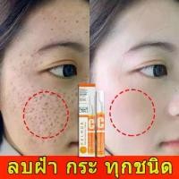 ราคา ราคาถูก- ✾eelhoe ทาฝ้าของแท้ ครีม แก้ ฝ้า กระ ครีมทาฝ้ากระ vitamin c ครีมแก้ฝ้าแท้ๆ ครีมแก้ฝ้าถาวร ครีมทาฝ้าหนาๆๆ การกำจัดกระที่ทร❄ (1735516480359400997)