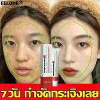 ราคา ผิวเป็นสิว ลบแผลเป็นจากสิวจุดด่างดำ ครีมกน้าขาวใส ครีมทาผิวกระ กระ ครีมไวท์เทนนิ่ง ครีมทาหน้าขาว โครีมทาฝ้ากระ ครีมทาฝ้ากระ ครีมแก้ฝ้าแท้ๆ ป้องกันริ้วรอย ดูกระจ่างผิวใส ทาฝ้าหนาลึก (173220476152476648