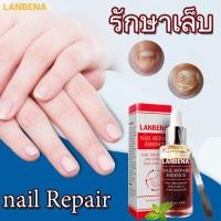 ราคา LANBENA รักษาเล็บ ไม่มีผลข้างเคียง เซรั่มรักษาเล็บ น้ำมันบำรุงเล็บ รักษาเล็บ เล็บขบ เชื้้อรา สมุนไพรรักษาเล็บขบ Nail Repair Essence Serum Fungal Nail Treatment Remove Onychomycosis Toe Nourishing Brig