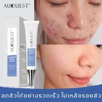 ราคา AuQuest เหมาะสำหรับผิวเป็นสิวน้อยและผิวเป็นสิวระดับปานกลาง รักษาสิวผด สิวผื่น แห้งไว ครีมแต้มสิวตัวเทพ ซ่อมแซมผิวหนัง ครีมรักษาสิว ครีมแต้มสิว Acne cream Black Spot Acne Remover Improves Dark Spots Ac