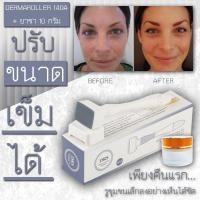 ราคา เดอร์มาแสตมป์ DRS derma Stamp Micro Neddle Pen 140A ปากกา เข็มรักษาหลุมสิว รอยสิว รูขุมขนกว้าง สามารถปรับระดับเข็มได้ 0 0 3 0 mm ยาชา (967910954)