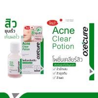 ราคา Oxecure Acne Clear Potion 15ml (967856243)