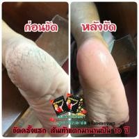 ราคา Madam Foot Spa รับประกัน ของแท้ สปาตีนคุณนาย สำหรับ ส้นเท้าเป็นขุย ตาตุ่มดำด้าน ส้นเท้าแตก ตีนแตก สปาเท้า อุปกรณ์ขัดเท้า ครีมทาส้นเท้าแตก ครีมส้นเท้าแตก ใช้แล้วเห็นผล 1 กล่อง ส่งฟรี เก็บเงินปลายทางได้