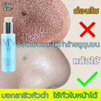 ราคา รูขุมขนหดตัว 120ml ทำให้ผิวขาวขึ้น เติมเต็มความชุ่มชื้นให้ผิว เซรั่มหน้าใส เซรั่มบำรุงผิว รูขุมขนหดตัว รูขุมขนกระชับขึ้น ไวท์เทนนิ่ง เซรั่มกระชับใบหน้า กรดไฮยาลูโรนิก เซรั่มบำรุงผิวหน้า เซรั่มกระชับ (