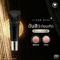 ราคา ครีมละลายสิว ละลายหัวสิวใต้ผิว แต้มลดการอักเสบของสิว ผิวไม่แห้งลอก 30 g Madamkikkiey มาดามกิ๊กกี้ พี่กุ้งกดสิว (19248934592)