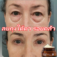 ราคา ครีมลดถุงใต้ตา ครีมทาขอบตาดำ eye cream retinol อายครีมลดริ้วรอย ลดริ้วรอย ต่อต้านริ้วรอย ลดถุงใต้ตา ต่อต้านริ้วรอย (17169229743)