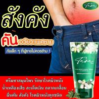 ราคา สมุนไพร ครีมทารา 1 หลอด ยาทาสังคัง ครีมทาแก้เชื้อรา ครีมแก้คัน ยาทาเชื้อรา แก้คันผิวหนัง ยาแก้เชื้อรา (15125253273)