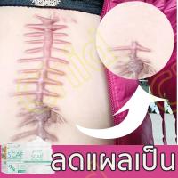 ราคา ครีมทาแผลเป็น ครีมแก้ขาลาย ลบรอยแผลเปน ลดรอยเเผลเป็น เหมาะสำหรับผิวรอยแตกลาย น้ำร้อนลวก แผลผ่าตัด แผลเป็นจากยุงกัด แก้ขาลาย ครีมลบรอยแผลดำ ทาขาลาย ครีมลดรอยแผลดำ ครีมทารอยแผลเป็น ครีมลดรอยแผลเป็น scar
