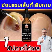 ราคา ยาเชื้อราเล็บ เชื้อราเล็บมือ ซ่อมแซมเล็บที่เสียหายทุกชนิดเร่งการเจริญเติบโตของเล็บ ความจุ 30ml เชื้อราที่เล็บ ยารักษาเล็บ บำรุงเล็บ ครีมบำรุงเล็บ ยารักษาเชื้อราที่เล็บ Fungal Nail (19887756946)