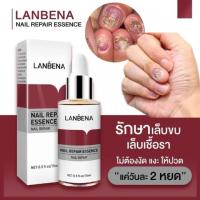 ราคา ของแท้ 100 LANBENA เซรั่มบำรุงเล็บ น้ำยาบำรุงเล็บ บำรุงเล็บ ต่อต้านการติตเชื้อรา ซ่อมแซมเล็บแตก เล็บเปราะ เล็บหนา (20605041030)
