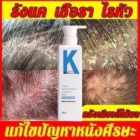 ราคา ของแท สูตรใหม่ล่าสุด KONOยาสระผมแก้เชื้อรา 500ml แชมพูยาเชื้อรา แก้เชื้อราที่หัว หนังศีรษะอักเสบ สิว หนังศีรษะกลับสู่สุขภาพ konoยาสระผม ยาสระผมรักษาสิว เชื้อราบนศีรษะ แชมพูป้องกันเชื้อรา ขจัดรังแค แช 