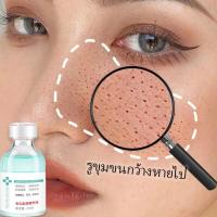 ราคา เซรั่มกระชับรูขุมขน เซรั่มหน้าใส รูขุมขนกระชับ เซรั่มบำรุงผิว ให้ความชุ่มชื้น เซรั่มหน้าใส เติมเต็มความชุ่มชื้นให้ผิว บำรุงผิวหน้า เซรั่มยกกระชับ เซรั่มหน้าใสไว ควบคุมความมัน ส รูขุมขนหดตัว เซรั่มลดรู