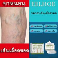 ราคา EELHOE เส้นเลือดขอด รักษาเส้นเลือดขอด ครีมทาเส้นเลือดขอด แมงมุมเส้นเลือดปวด ฟื้นบำรุงผิวที่สมบูรณ์แบบ รักษาขาให้สวย บรรเทาเส้นเลือดขอด Varicose Vein Cream 50g (20151345137)