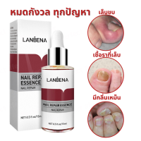 ราคา LANBENA เซรั่มบำรุงเล็บ เซรั่มซ่อมเล็บ เชื้อรา เล็บขบ แก้ปัญหาเล็บ ให้สุขภาพดี (19329017625)